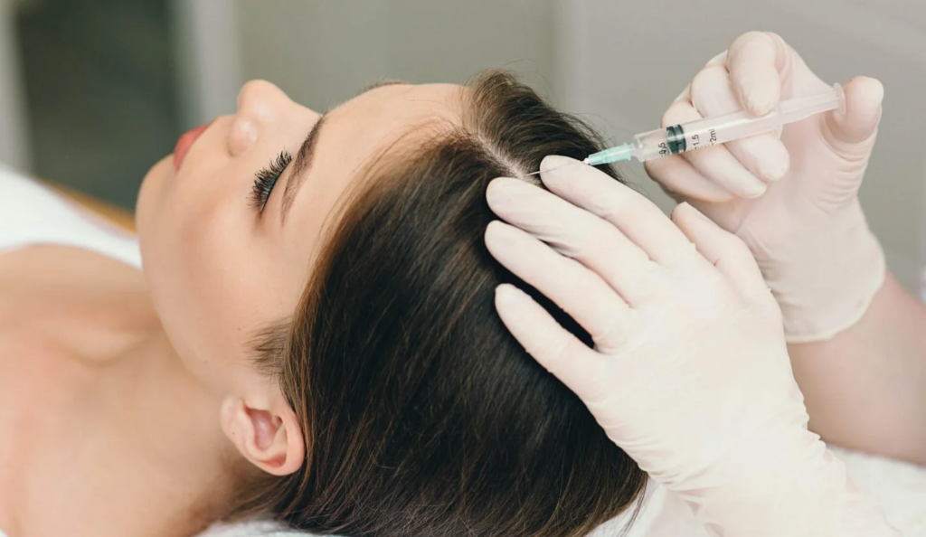 The Cultural Acceptance of PRP Therapy for Hair Loss Dubai