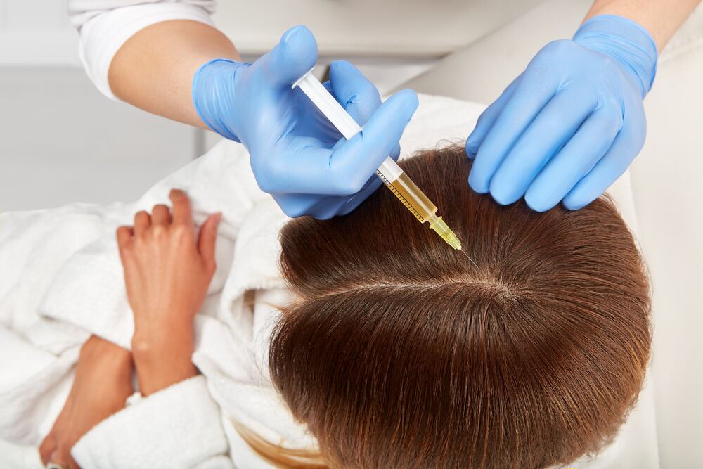 Upfront and Long-term Costs of PRP Hair Therapy in Dubai