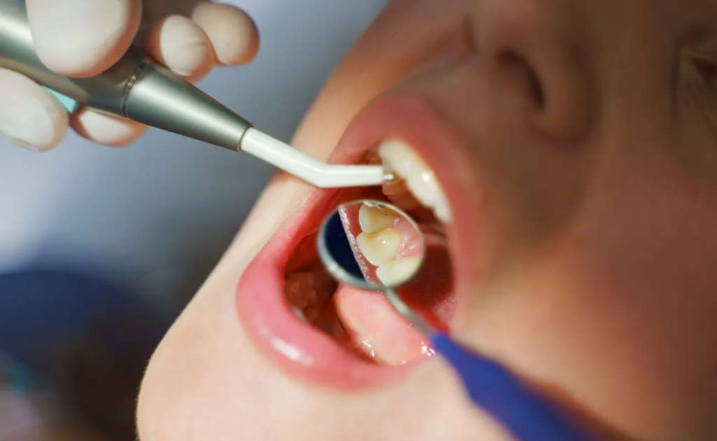 Target different audiences: Student-Friendly Tooth Filling