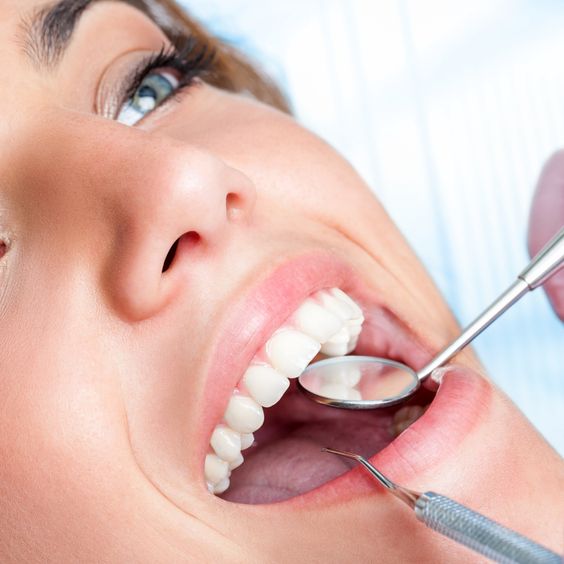 Tooth Fractures and Fillings: A Comprehensive Guide in Dubai