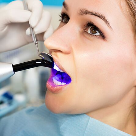 Show off your smile with Dubai’s premier tooth filling