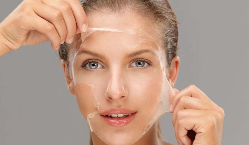 Chemical Peel Service New Hyde Park at Nuderm Asthetics