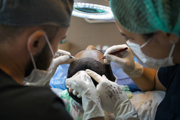 Hair Transplant in Abu Dhabi: The Ultimate Guide for Newcome