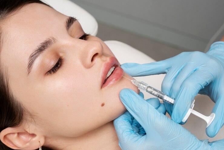Enhance Your Lips with Botox