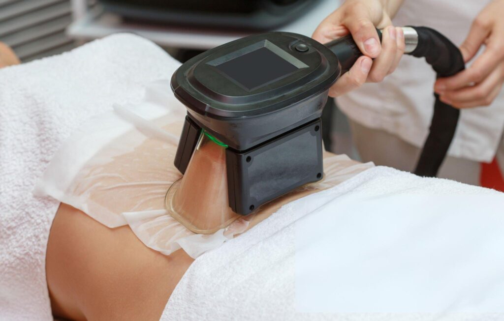 Sculpt Your Dream Body with Fat Freezing Bournemouth at Skin