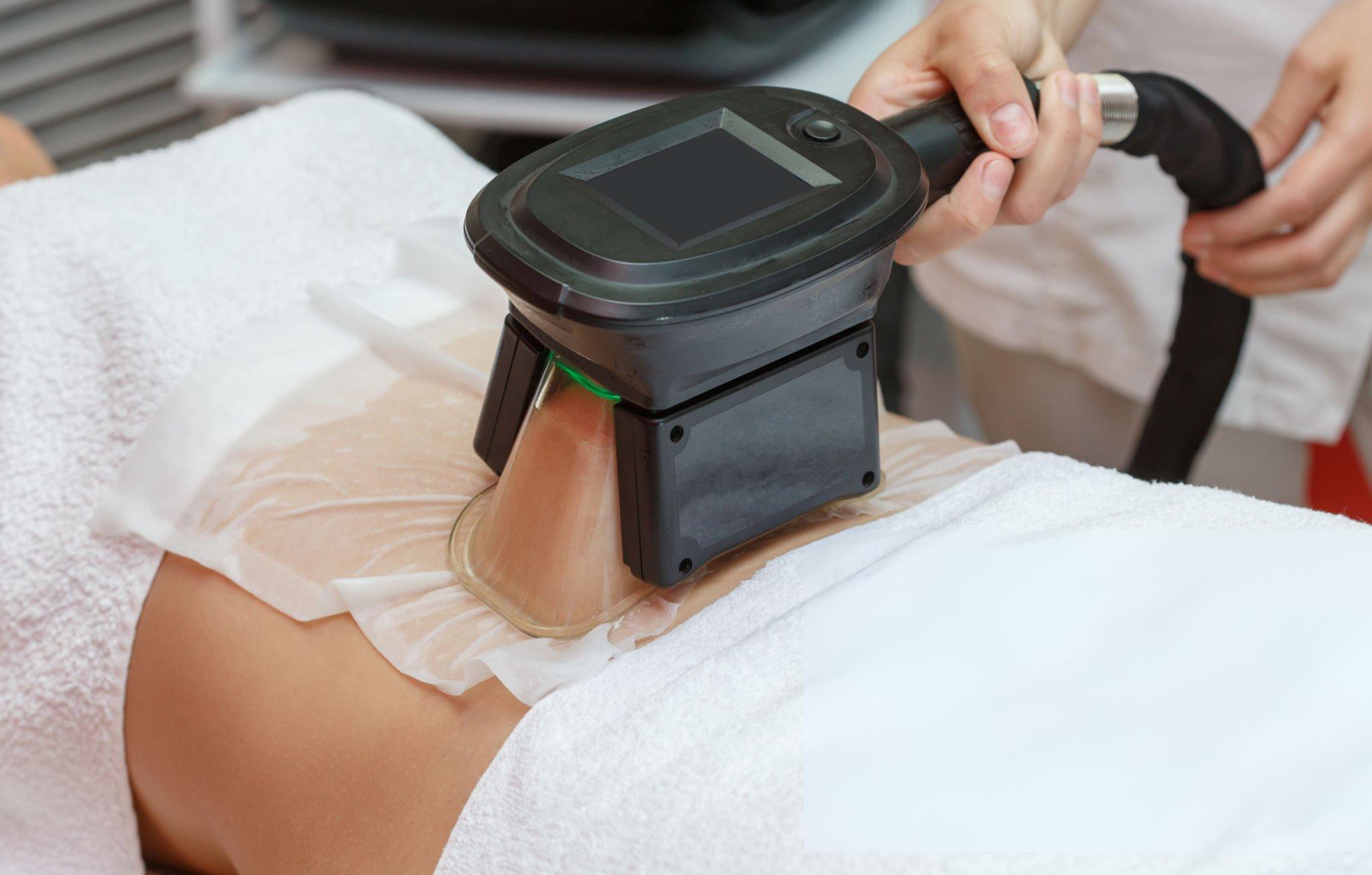 Sculpt Your Dream Body with Fat Freezing Bournemouth at Skin
