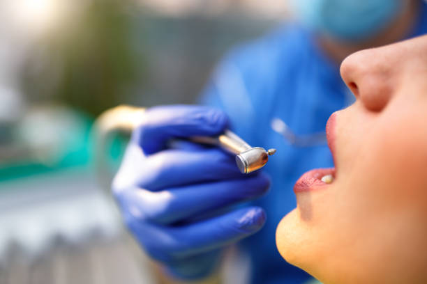 Everything You Need to Know About Dental Crowns in Whittier
