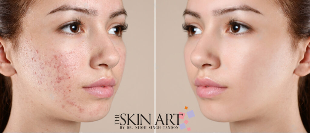 Best Dermatologist in Lucknow for Comprehensive Skin and Hai