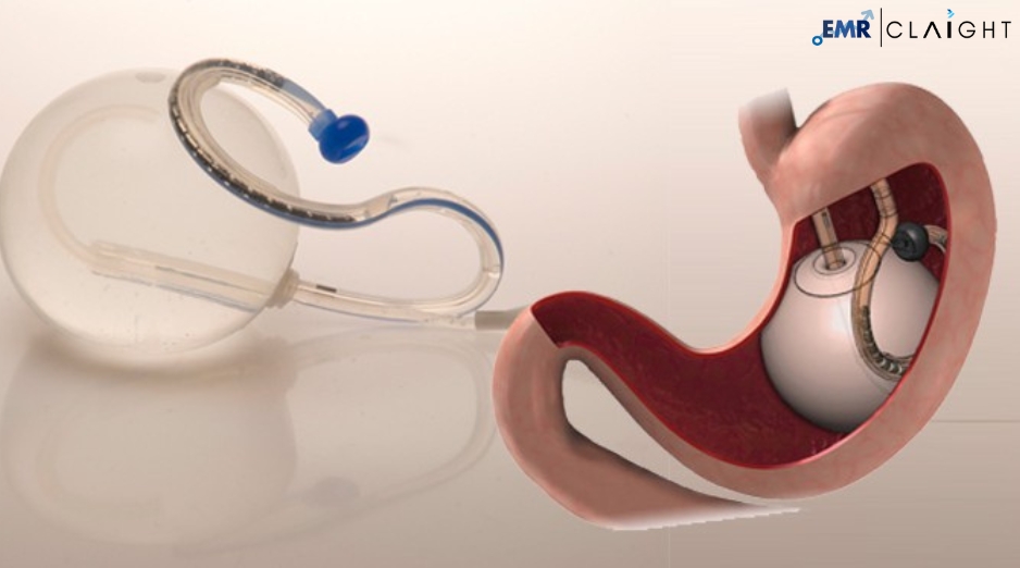Europe Balloon Catheters Market Size, & Growth | 2032