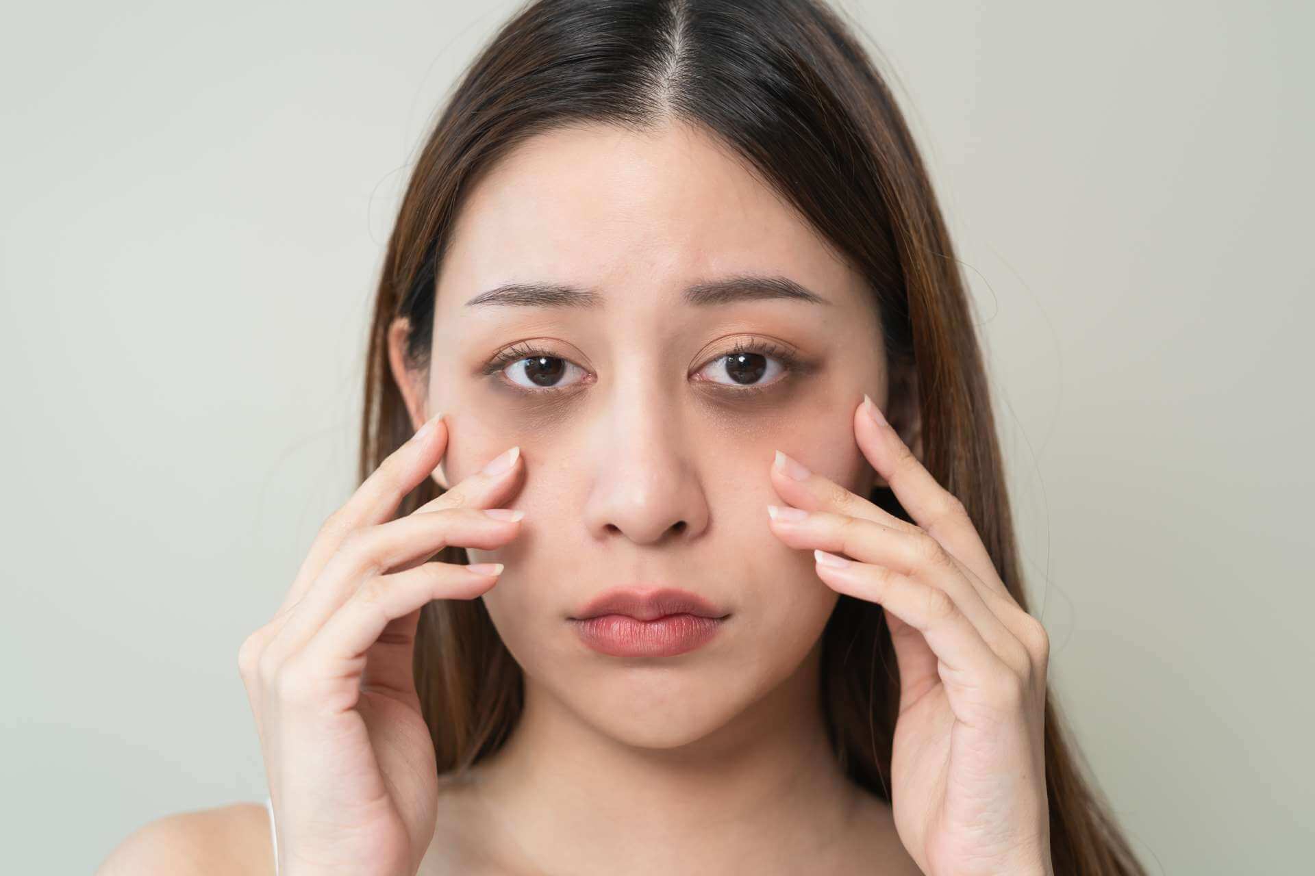Are There Any Quick Solutions for Dark Circles in Dubai?