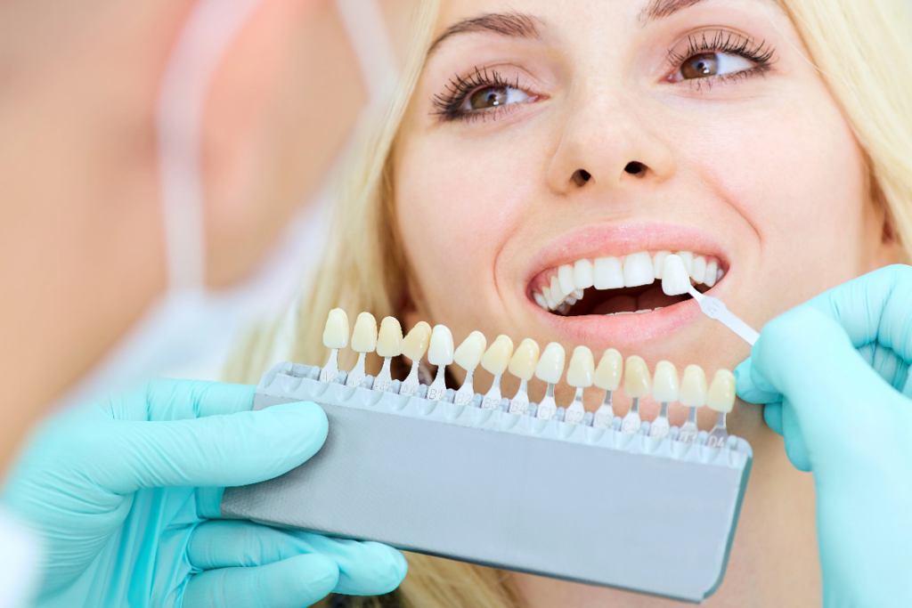 How Teeth Whitening Can Transform Your Confidence and Smile