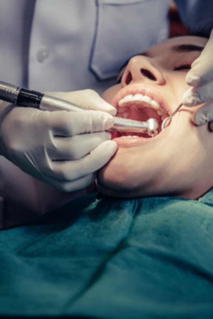 dental filling treatment in Riyadh