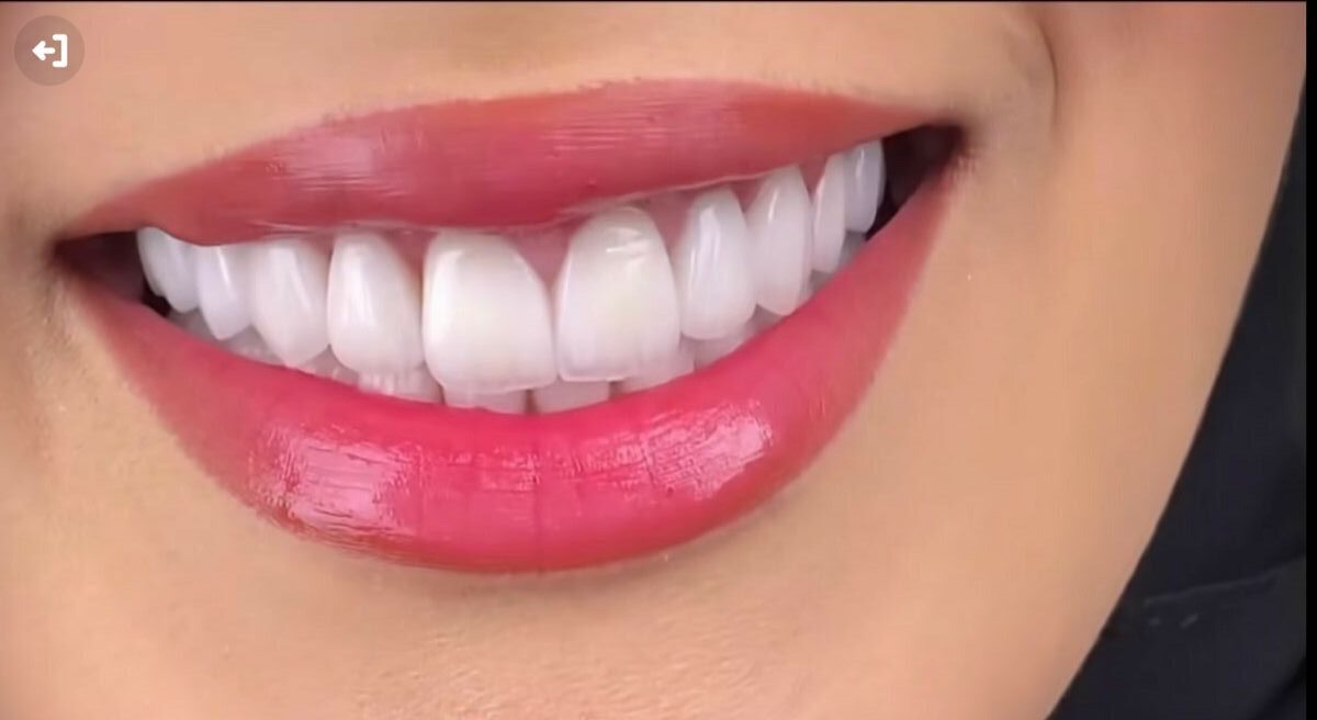 A beautiful smile enhances confidence and leaves a lasting i