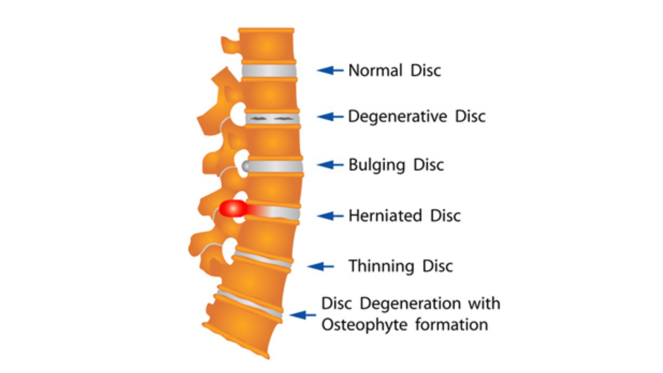How to Find the Best Pain Management for Back Pain Near You?