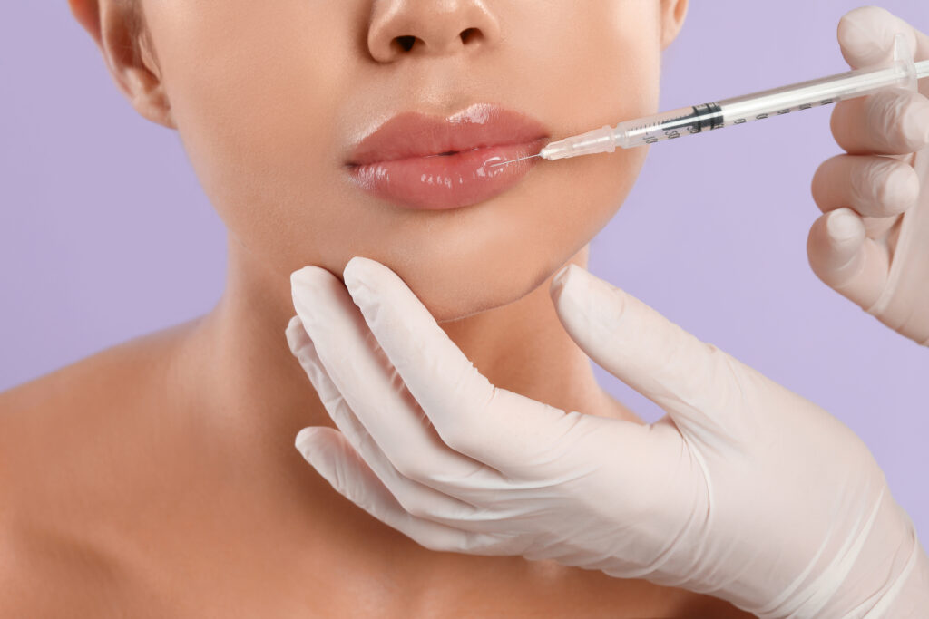 Lip Fillers for Mature Lips: Rejuvenation Without Surgery
