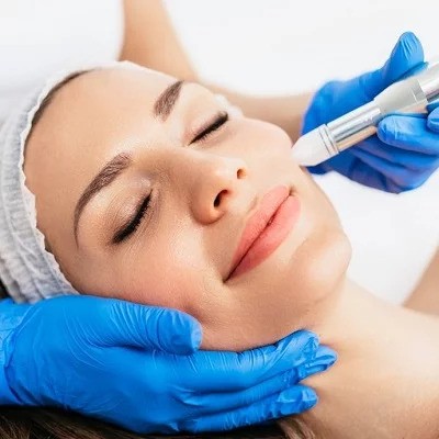 Reduce Acne Scars with Microneedling Therapy