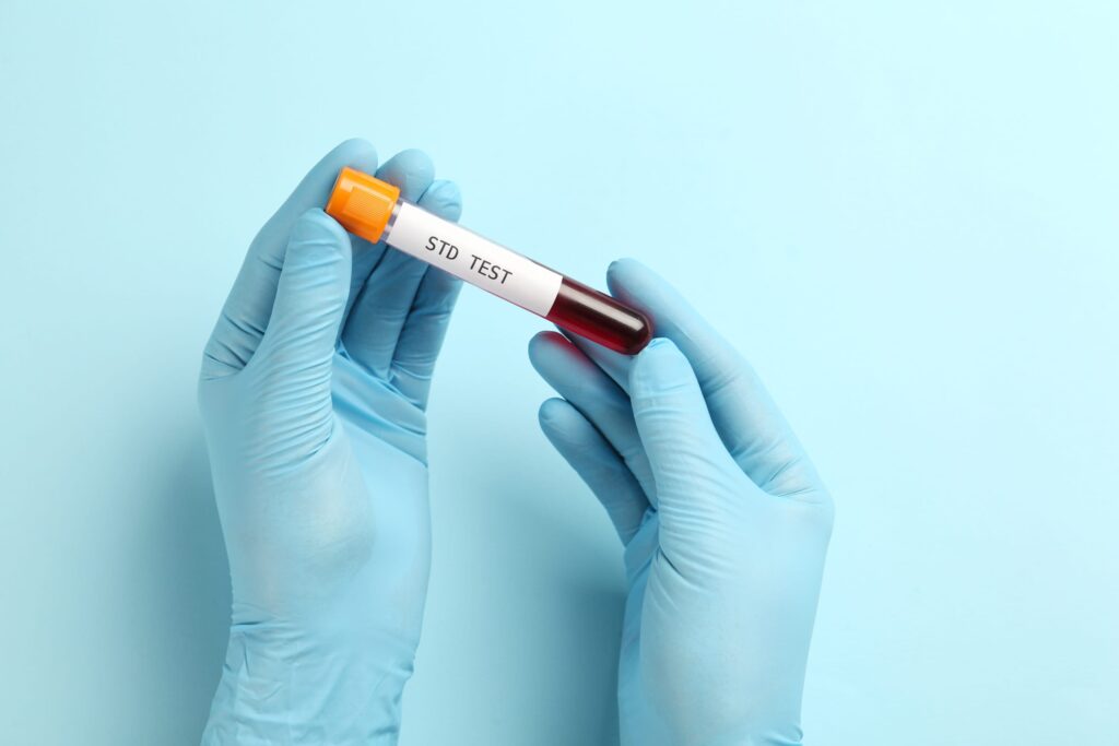 Trusted STD Tests in Dubai: What You Need