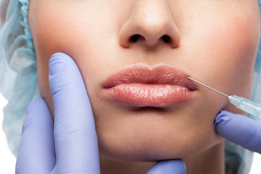 Subtle or Bold? Customize Your Lip Fillers Injections Dubai
