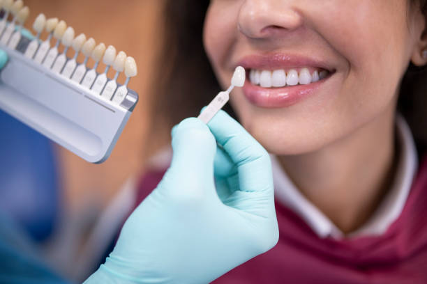 Cost of Teeth Cleaning and Polishing in Riyadh 2025