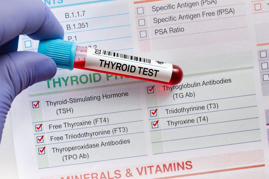 Why Do More Women Suffer from Thyroid Problems Than Men?