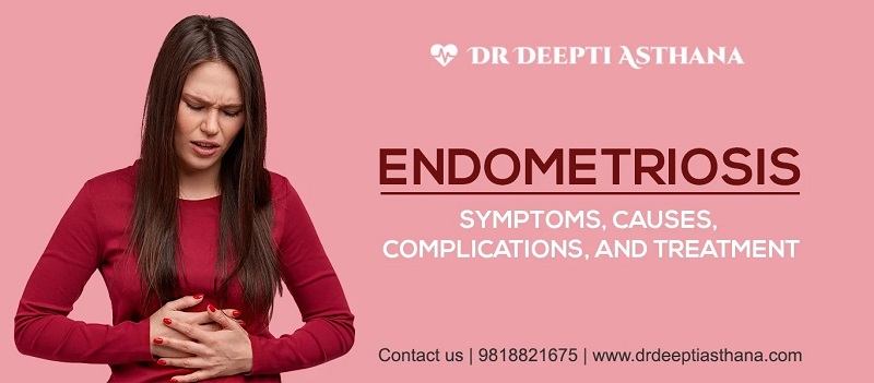 Expert in Ovarian Cyst Treatments in Gurgaon