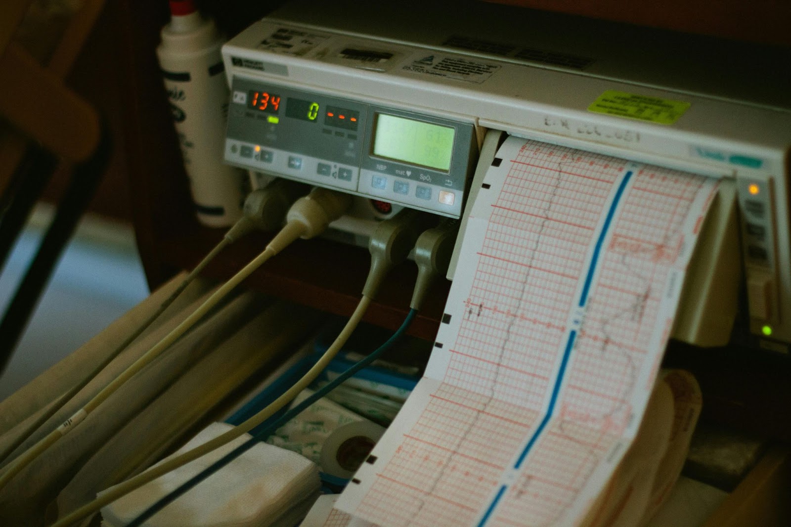 2D Echo Test in Nagpur: When and Why You Need It