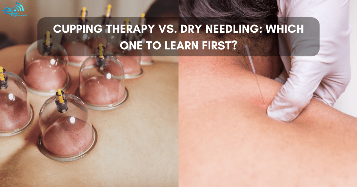 Cupping Therapy vs. Dry Needling: Which One to Learn First?