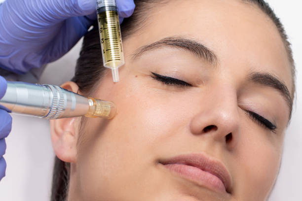 New PoThe Science Behind the Derma Pen and Skin Regeneratist