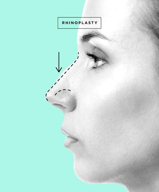 Exploring Non-Surgical Alternatives to Rhinoplasty in Dubai