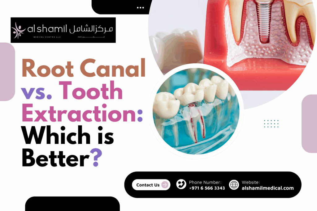 Root Canal vs. Tooth Extraction: Which is Better?