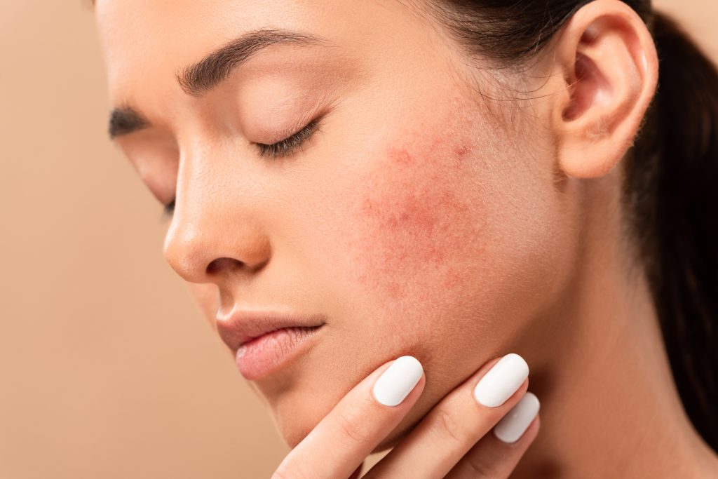 How Do I Choose The Best Dermatologist For My Skin Type?