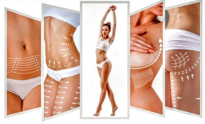 Radio Frequency Body Contouring in Islamabad: What to Know