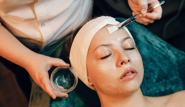 Chemical Peels in Riyadh for Pigmentation Care