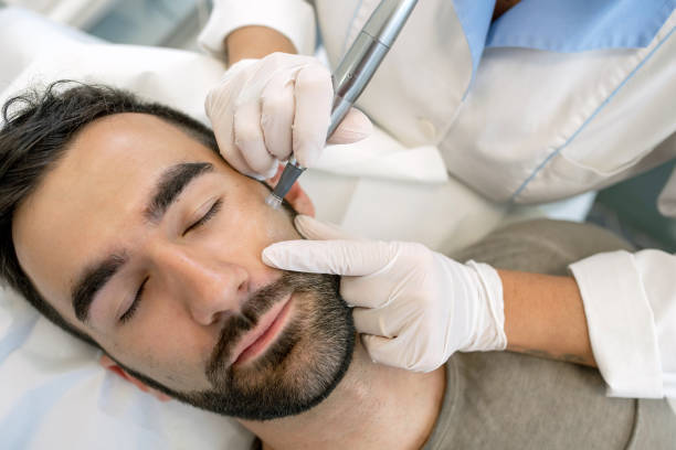 How the Derma Pen Rejuvenates Skin Without Surgery