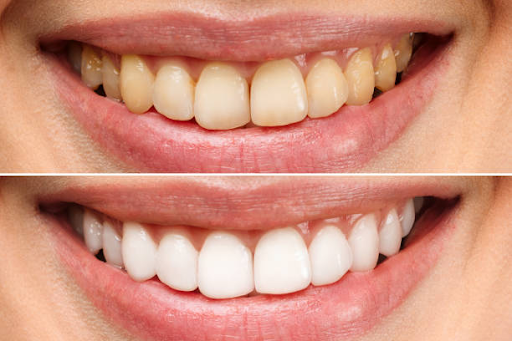 Trusted & Affordable Dental Services in Fort Worth, Texas