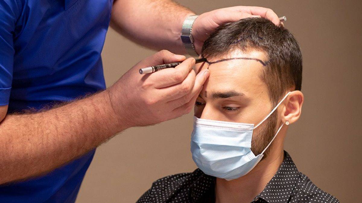 Can Hair Transplants Fail? What Islamabad Patients Should Kn