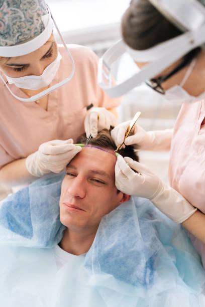 Hair Transplant Recovery in Dubai: Timeline, Tips, and What