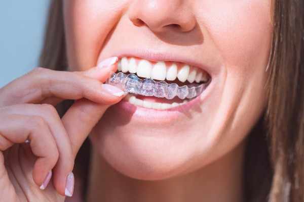 Professional Tooth Repair and Cleaning Services in Blackpool