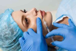 Lip Filler