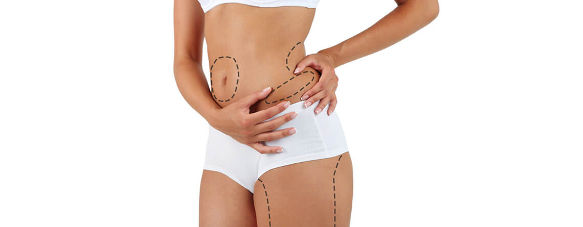 Latest Advances in Liposuction Technology in Islamabad