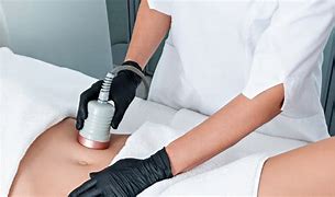 Why PURE Medical Spa Is the Gold Standard for Body Contourin
