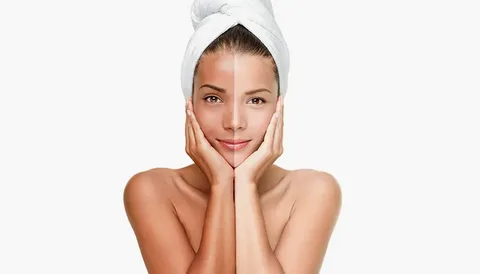 The Popularity of Skin Whitening Masks in Islamabad