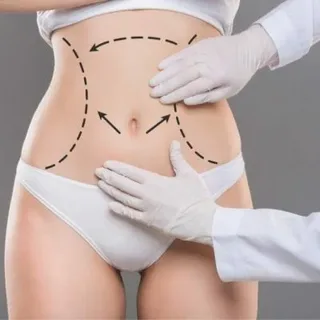 Risks and Side Effects of Tummy Tuck in Islamabad
