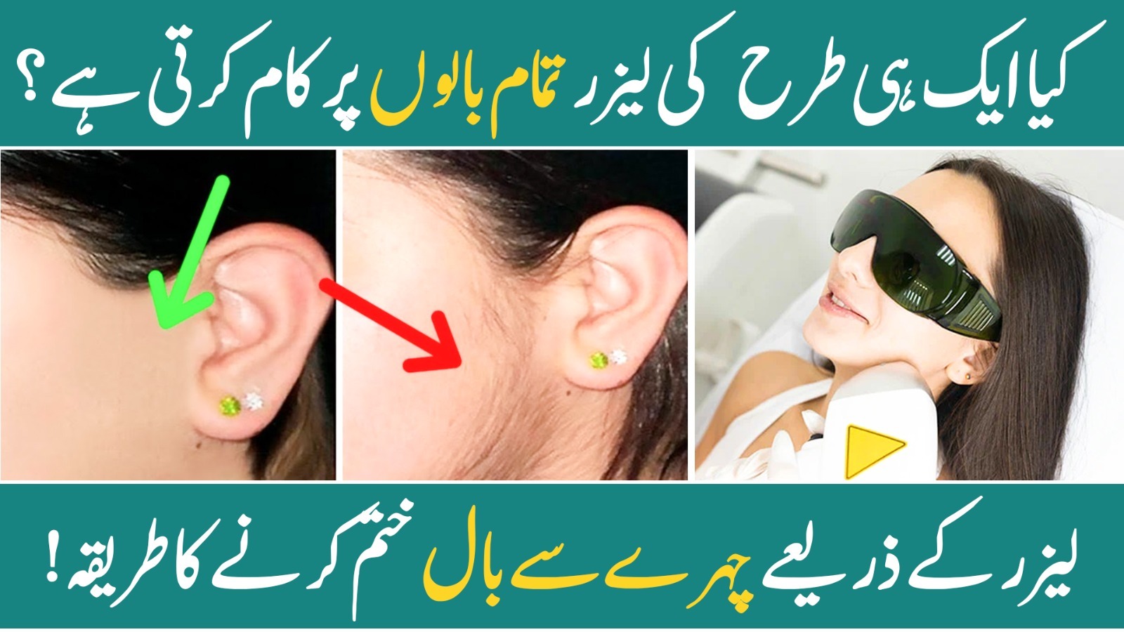 Say Goodbye to Thick Facial Hair with Laser Treatment