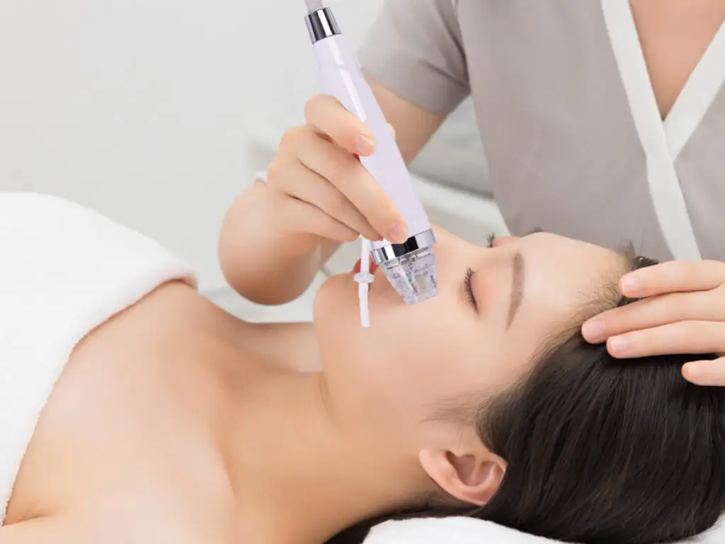 Fractional RF Microneedling: Non-Invasive Skin Treatment