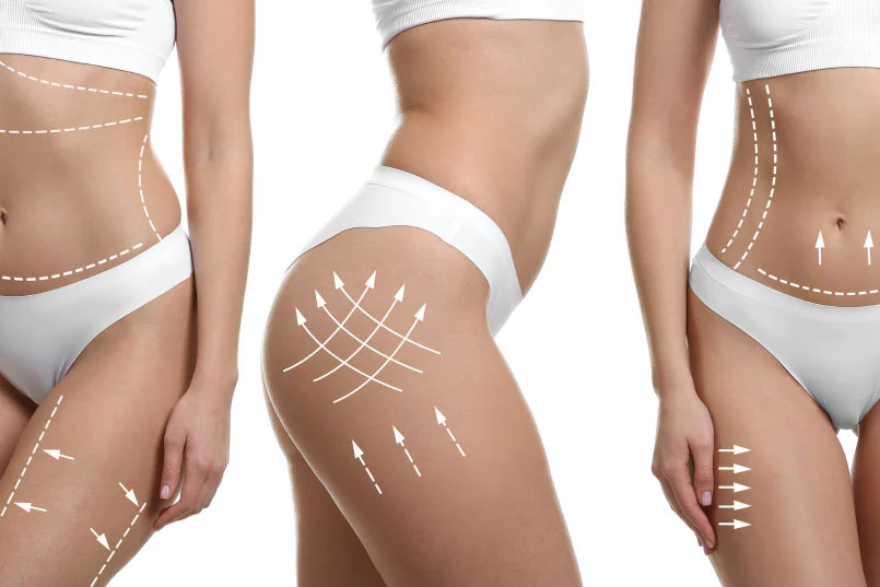 Why Plastic Surgery in Riyadh Is Trending