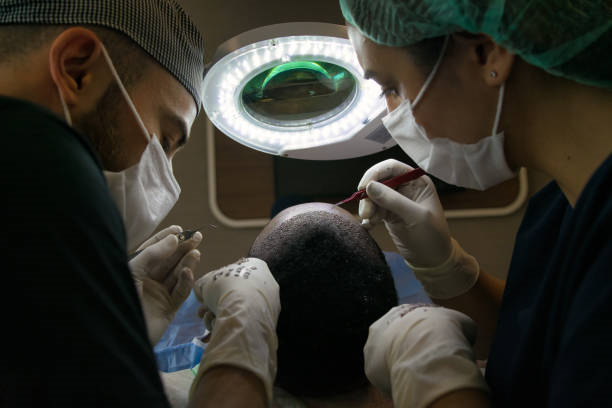 زراعة الشعر في الرياض تجنب هذه الأخطاء الشائعة
